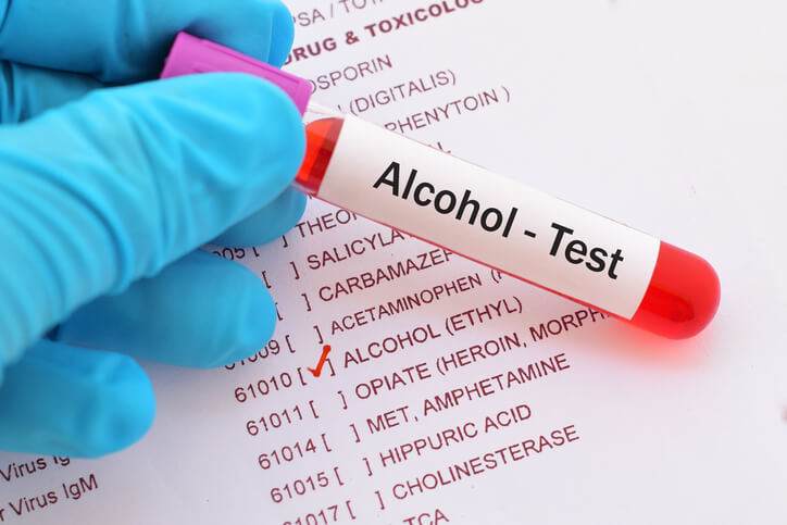 Drug and alcohol testing services